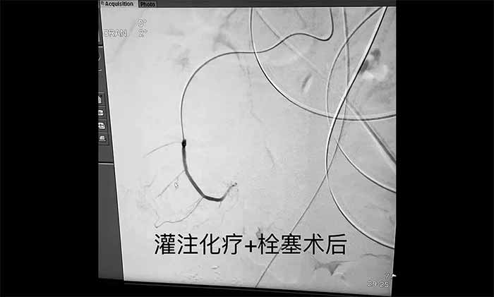 �������� ҽ������ | ��Ժ��������ע��������Ѫ��˨�����뼼�����ٶ�������������·��